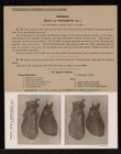 Thorax. Heart and Pericardium - no. 1